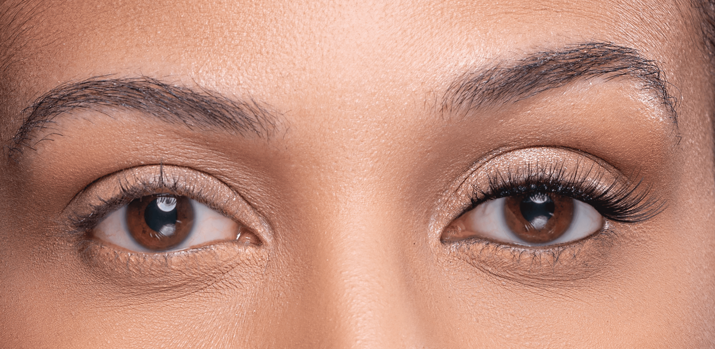 Comparison of eyes with and without Night Life Lash